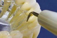 Satelec Universal