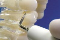 Satelec 10X Interproximal